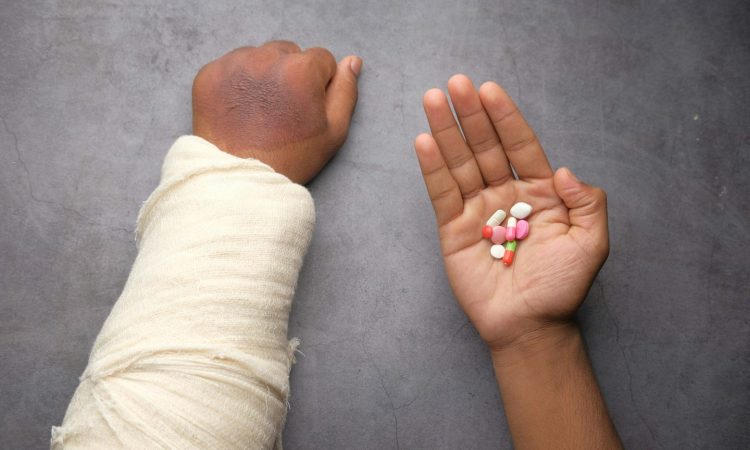 Expert Reports in Personal Injury Claims: Why Expert Opinions Carry Weight and How They Are Assessed